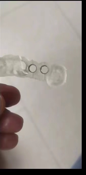 수지 치과용 3D 프린터 심기 가이드 수지 고정밀 인성 - 3D Printing Guide 리뷰 및 가격